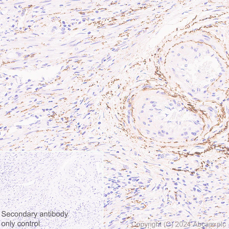 Immunohistochemistry (Formalin/PFA-fixed paraffin-embedded sections) - Anti-COL8A1 antibody [EPR28738-178] - BSA and Azide free (AB318973)