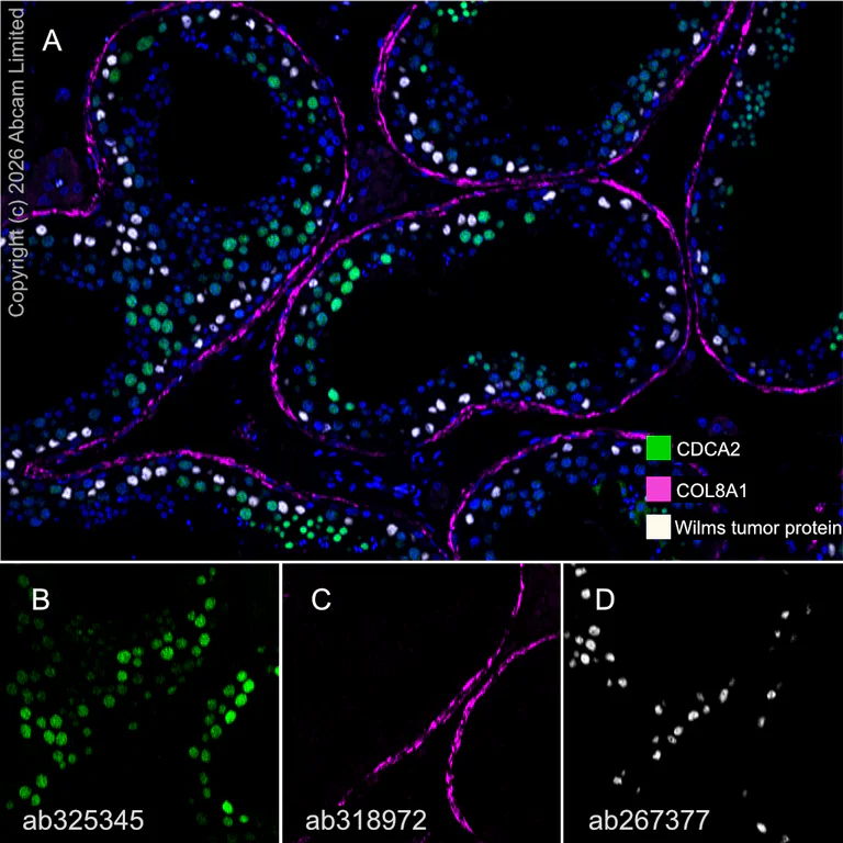 Multiplex immunohistochemistry - Anti-COL8A1 antibody [EPR28738-178] - BSA and Azide free (AB318973)
