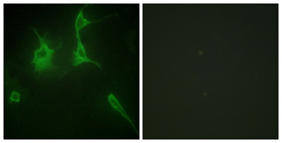 Immunocytochemistry/ Immunofluorescence - Anti-COL9A3 antibody (AB196591)