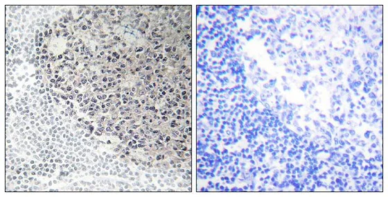 Immunohistochemistry (Formalin/PFA-fixed paraffin-embedded sections) - Anti-COL9A3 antibody (AB196591)