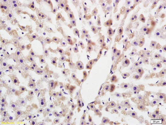 Immunohistochemistry (Formalin/PFA-fixed paraffin-embedded sections) - Anti-COLEC10 antibody (AB213156)