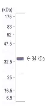 Western blot - Anti-COLEC11 antibody [821] (AB278063)