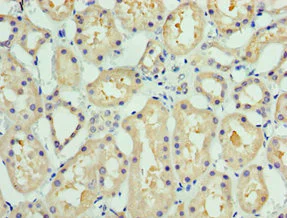 Immunohistochemistry (Formalin/PFA-fixed paraffin-embedded sections) - Anti-COLEC11 antibody (AB238585)