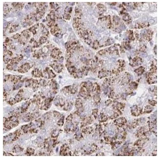 Immunohistochemistry (Formalin/PFA-fixed paraffin-embedded sections) - Anti-Collagen alpha-1(XXVIII) chain antibody - C-terminal (AB188533)