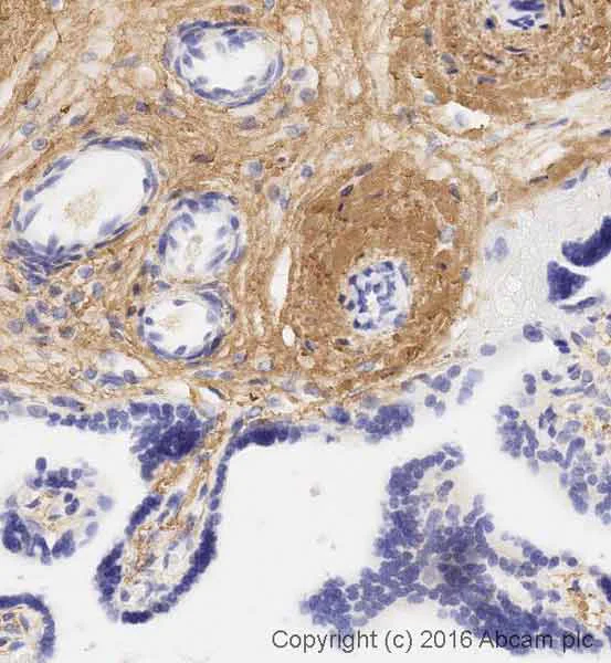 Immunohistochemistry (Formalin/PFA-fixed paraffin-embedded sections) - Anti-Collagen I antibody [3G3] - BSA and Azide free (AB88147)