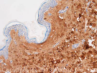 Immunohistochemistry (Formalin/PFA-fixed paraffin-embedded sections) - Anti-Collagen I antibody [3G3] - BSA and Azide free (AB88147)