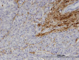 Immunohistochemistry (Formalin/PFA-fixed paraffin-embedded sections) - Anti-Collagen I antibody [3G3] - BSA and Azide free (AB88147)