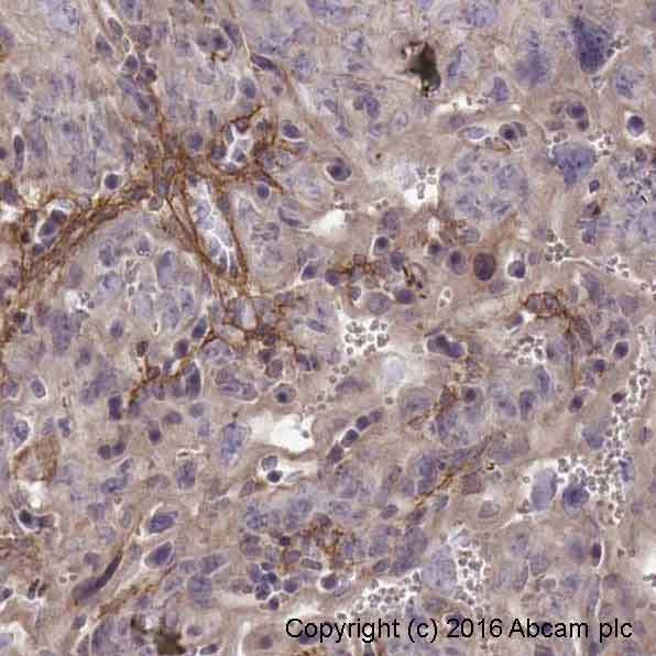 Immunohistochemistry (Formalin/PFA-fixed paraffin-embedded sections) - Anti-Collagen I antibody [3G3] - BSA and Azide free (AB88147)