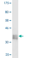 Western blot - Anti-Collagen I antibody [3G3] - BSA and Azide free (AB88147)