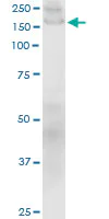 Western blot - Anti-Collagen I antibody [3G3] - BSA and Azide free (AB88147)