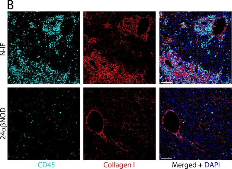 Immunohistochemistry (Formalin/PFA-fixed paraffin-embedded sections) - Anti-Collagen I antibody (AB21286)