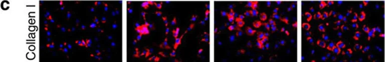 Immunohistochemistry (Frozen sections) - Anti-Collagen I antibody (AB21286)
