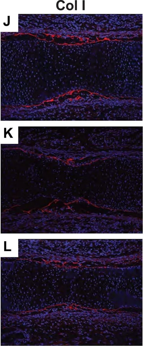 Immunohistochemistry (Frozen sections) - Anti-Collagen I antibody (AB21286)