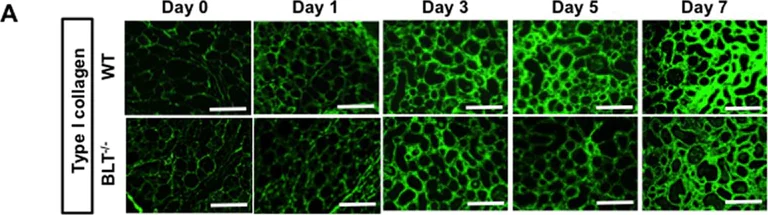 Immunohistochemistry (Frozen sections) - Anti-Collagen I antibody (AB21286)