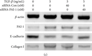 Western blot - Anti-Collagen I antibody (AB21286)