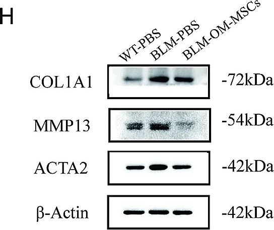 Western blot - Anti-Collagen I antibody (AB21286)