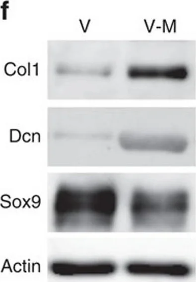 Western blot - Anti-Collagen I antibody (AB21286)
