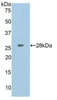 Western blot - Anti-Collagen I antibody (AB233080)