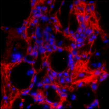 Immunohistochemistry (Formalin/PFA-fixed paraffin-embedded sections) - Anti-Collagen I antibody (AB254113), expandable thumbnail