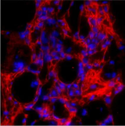 Immunohistochemistry (Formalin/PFA-fixed paraffin-embedded sections) - Anti-Collagen I antibody (AB254113)