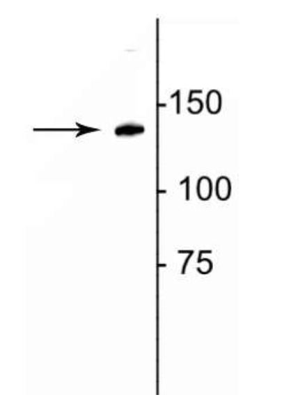 Western blot - Anti-Collagen I antibody (AB254113), expandable thumbnail