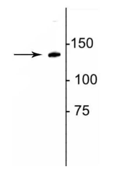Western blot - Anti-Collagen I antibody (AB254113)