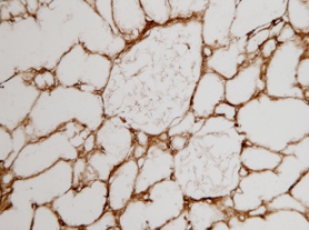 Immunohistochemistry (Frozen sections) - Anti-Collagen I antibody [COL-1] (AB6308), expandable thumbnail