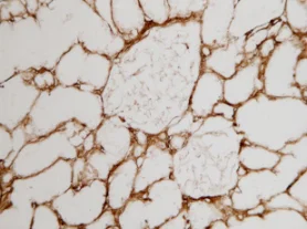 Immunohistochemistry (Frozen sections) - Anti-Collagen I antibody [COL-1] (AB6308)