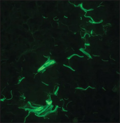 Immunohistochemistry (Frozen sections) - Anti-Collagen I antibody [COL-1] (AB6308)