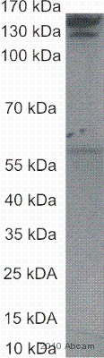 Western blot - Anti-Collagen I antibody [COL-1] (AB6308), expandable thumbnail