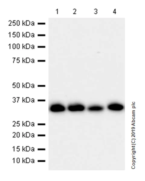 Western blot - Anti-Collagen I antibody [EPR22209-75] (AB255809)