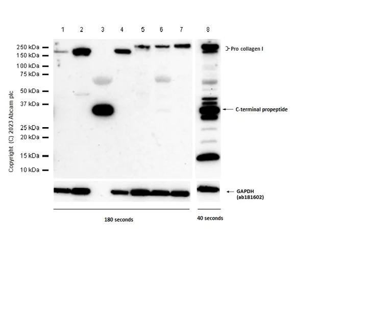 Western blot - Anti-Collagen I antibody [EPR22209-75] - BSA and Azide free (AB256541)