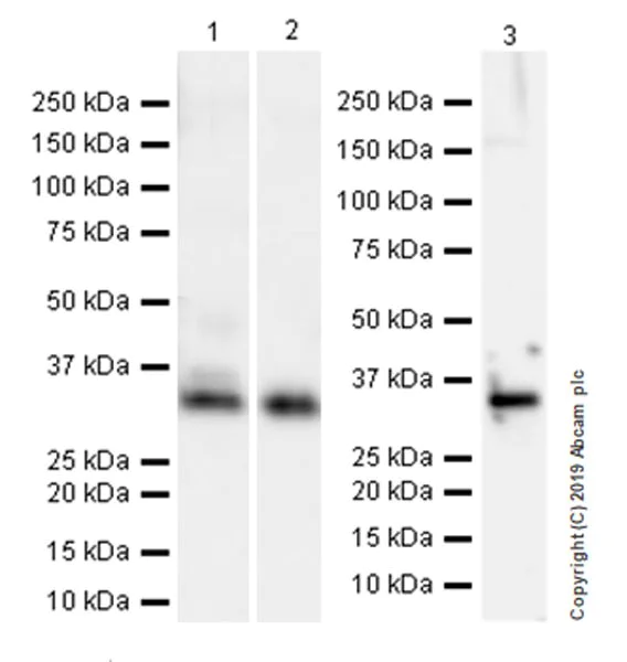 Western blot - Anti-Collagen I antibody [EPR22894-89] (AB260043)