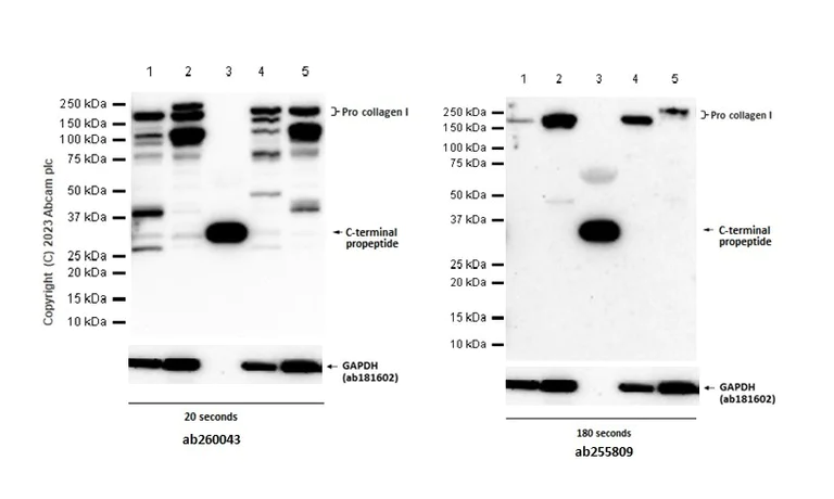 Western blot - Anti-Collagen I antibody [EPR22894-89] - BSA and Azide free (AB264074)