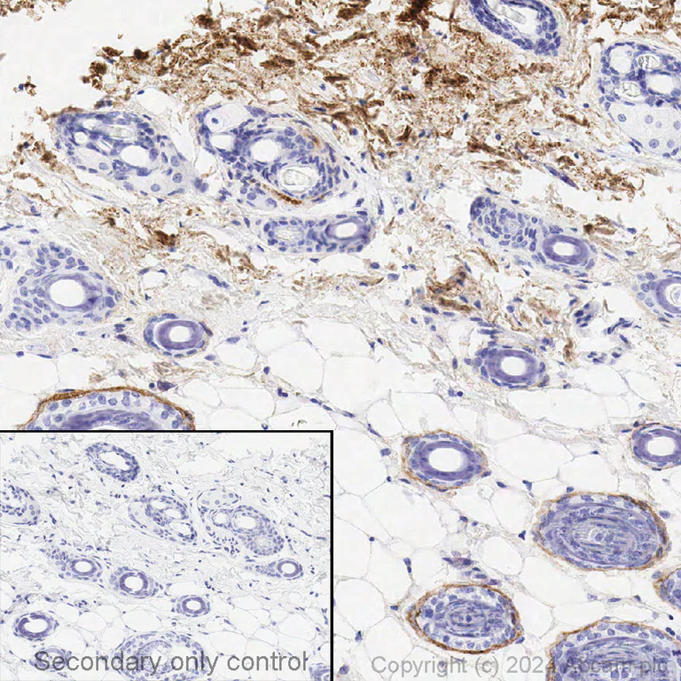 Immunohistochemistry (Formalin/PFA-fixed paraffin-embedded sections) - Anti-Collagen I antibody [EPR24331-53] (AB270993)