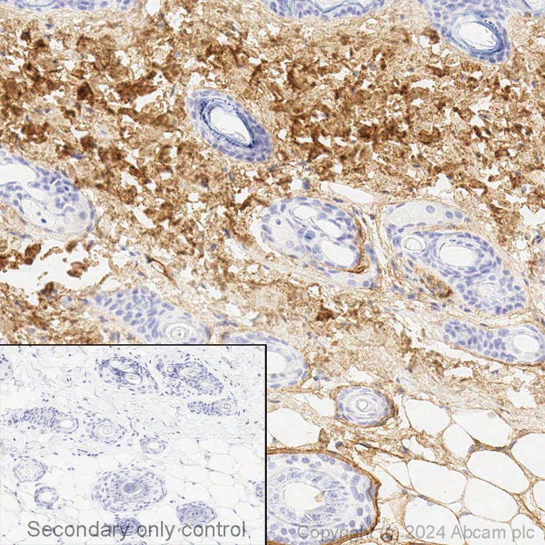 Immunohistochemistry (Formalin/PFA-fixed paraffin-embedded sections) - Anti-Collagen I antibody [EPR24331-53] (AB270993)