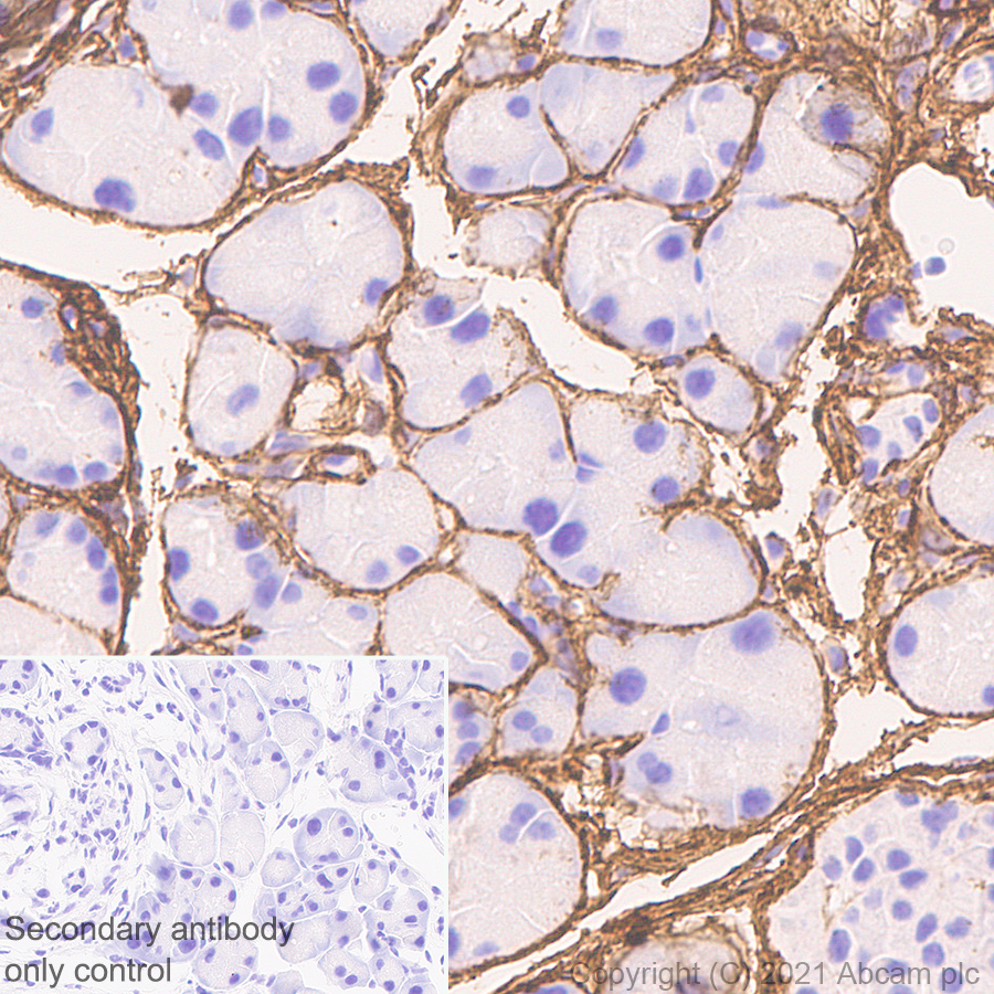 Immunohistochemistry (Formalin/PFA-fixed paraffin-embedded sections) - Anti-Collagen I antibody [EPR24331-53] - BSA and Azide free (ab279711), expandable thumbnail