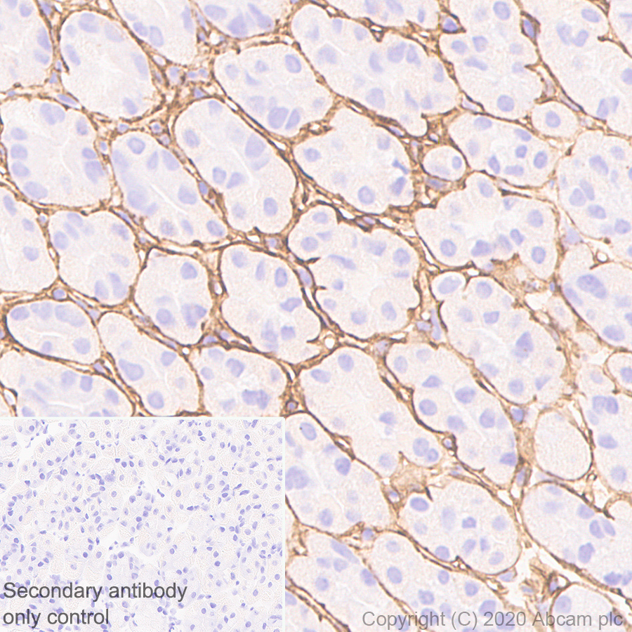 Immunohistochemistry (Formalin/PFA-fixed paraffin-embedded sections) - Anti-Collagen I antibody [EPR24331-53] - BSA and Azide free (ab279711), expandable thumbnail