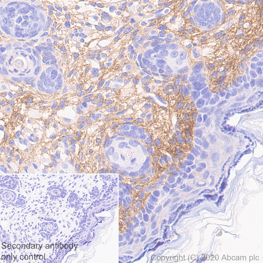 Immunohistochemistry (Formalin/PFA-fixed paraffin-embedded sections) - Anti-Collagen I antibody [EPR24331-53] - BSA and Azide free (AB279711), expandable thumbnail