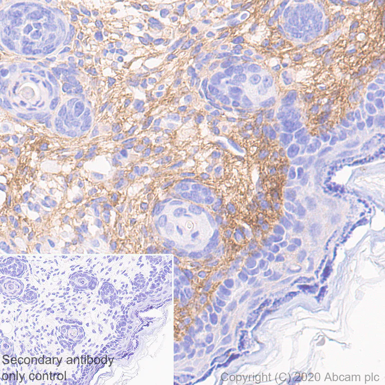 Immunohistochemistry (Formalin/PFA-fixed paraffin-embedded sections) - Anti-Collagen I antibody [EPR24331-53] - BSA and Azide free (AB279711)