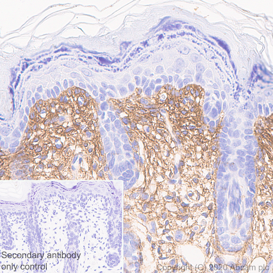 Immunohistochemistry (Formalin/PFA-fixed paraffin-embedded sections) - Anti-Collagen I antibody [EPR24331-53] - BSA and Azide free (ab279711), expandable thumbnail