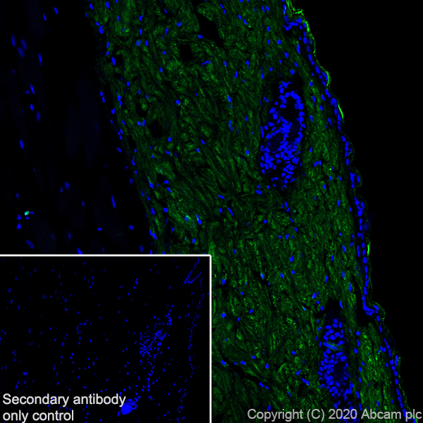 Immunohistochemistry (Frozen sections) - Anti-Collagen I antibody [EPR24331-53] - BSA and Azide free (AB279711), expandable thumbnail