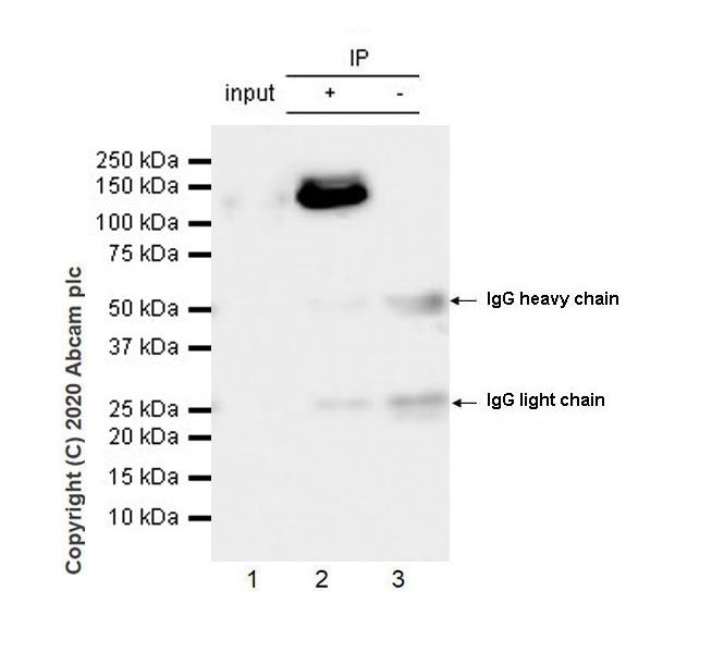 Immunoprecipitation - Anti-Collagen I antibody [EPR24331-53] - BSA and Azide free (AB279711), expandable thumbnail