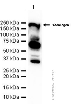 Western blot - Anti-Collagen I antibody [EPR24331-53] - BSA and Azide free (AB279711), expandable thumbnail