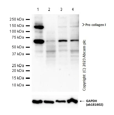 Western blot - Anti-Collagen I antibody [EPR24331-53] - BSA and Azide free (AB279711)