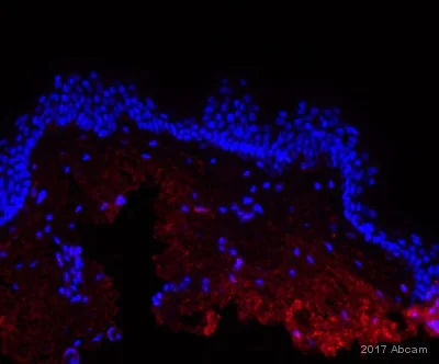 Immunohistochemistry (Formalin/PFA-fixed paraffin-embedded sections) - Anti-Collagen I antibody [EPR7785] (AB138492)