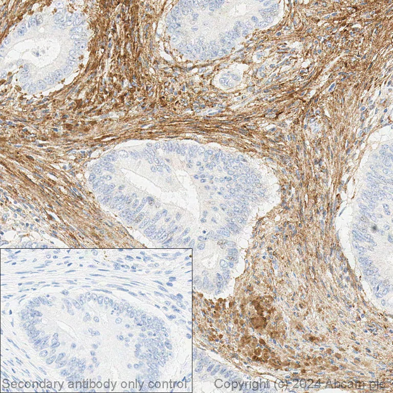 Immunohistochemistry (Formalin/PFA-fixed paraffin-embedded sections) - Anti-Collagen I antibody [EPR7785] (AB138492)