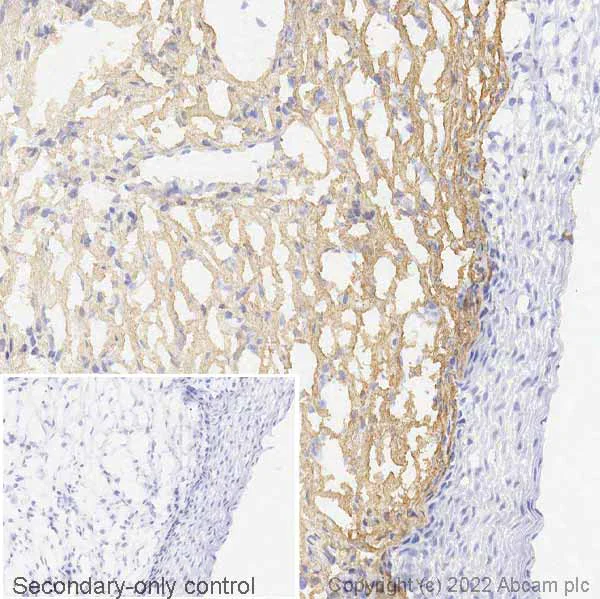 Anti-alpha-1 type I collagen antibody [EPR7785] (ab138492