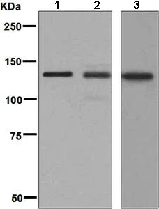 Western blot - Anti-Collagen I antibody [EPR7785] (AB138492)