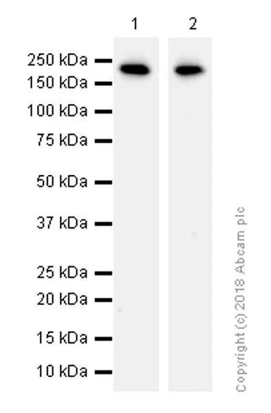Western blot - Anti-Collagen I antibody [EPR7785] (AB138492)